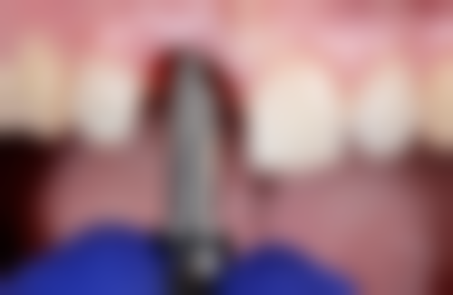 深圳慈恩齿科张雄英医生上班时间：每天上午九点-下午六点