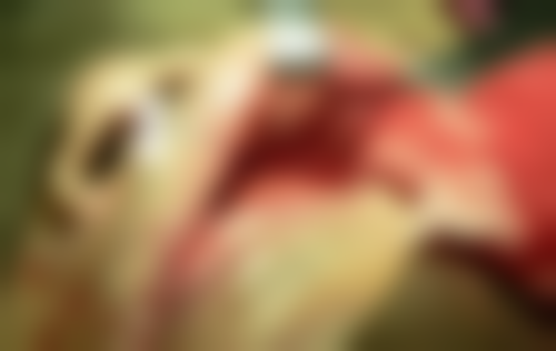 重庆团圆口腔种植牙优惠