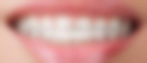 广州好佰年口腔门诊部（万博城店）实例参考