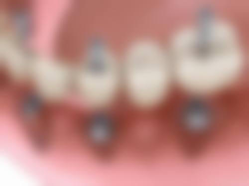 银川雅博仕沃田口腔门诊部怎么预约？