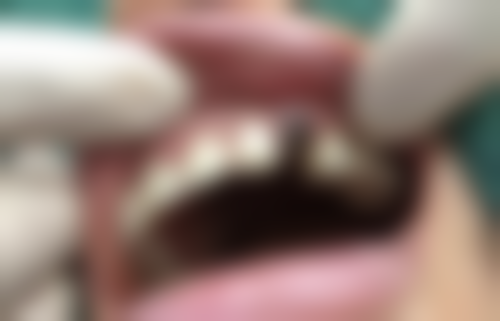 苏州陆星美奥口腔诊所价格表（仅供参考）