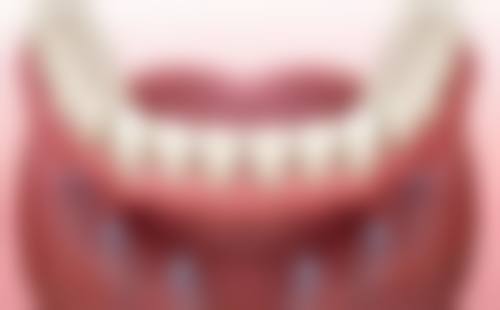 洛阳云亮口腔核心项目