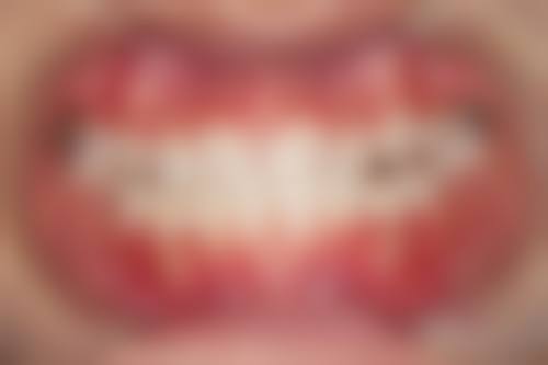 北京劲松口腔望京医院价格表(仅供参考)