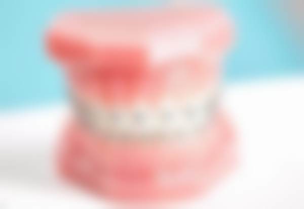 贵阳牙之都口腔门诊部价格表（仅供参考）