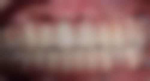 山东济南天桥铂飞特口腔怎么预约？