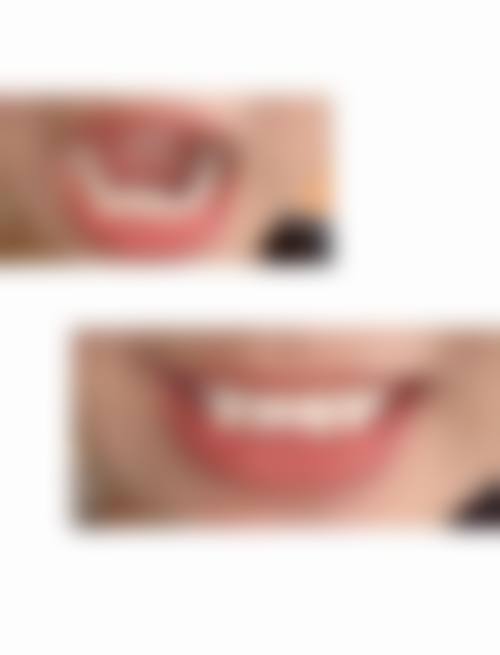 南通曹氏口腔诊所怎么预约？