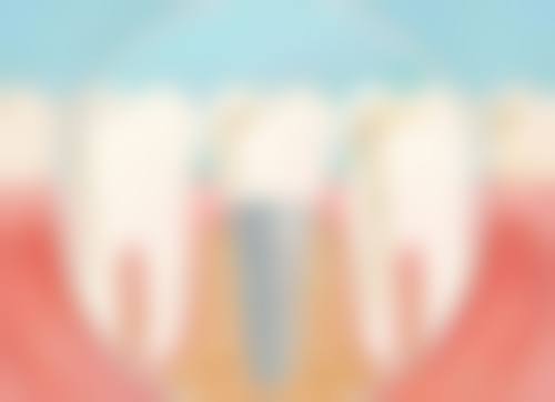 王吉成擅长项目列表