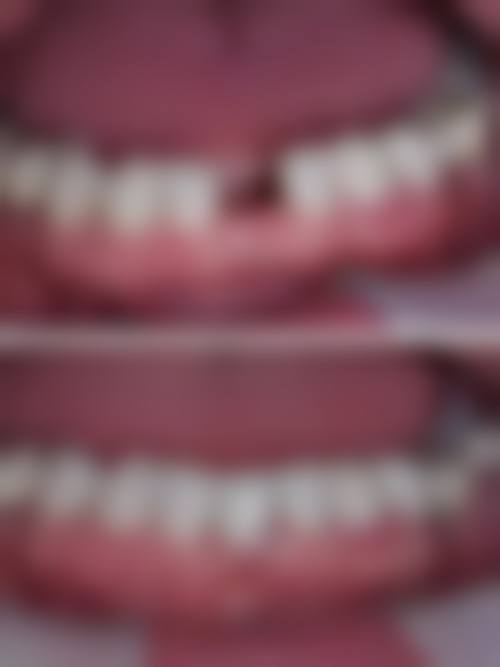 兰溪惠好口腔价格表(仅供参考)