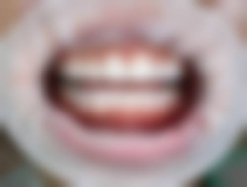 优享口腔医院实例参考