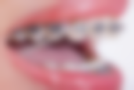 深圳佑诺口腔实例参考