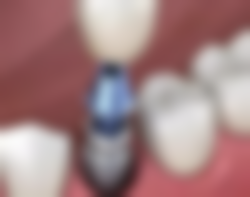 无锡维乐口腔(五爱路店)实例参考