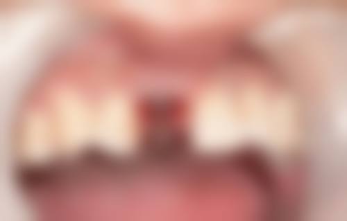 东莞洁丽口腔价格表(仅供参考)