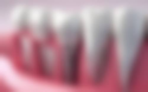 雷州新城卓越口腔诊所核心项目