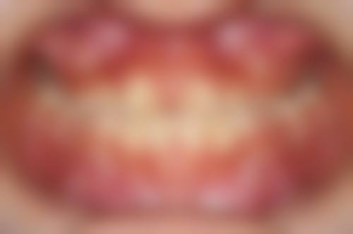 东莞洁丽口腔怎么预约?