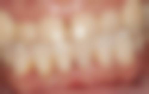 上海拜博口腔（浦尔店）核心项目