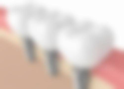 陕西渭南富平信远口腔价格表（仅供参考）