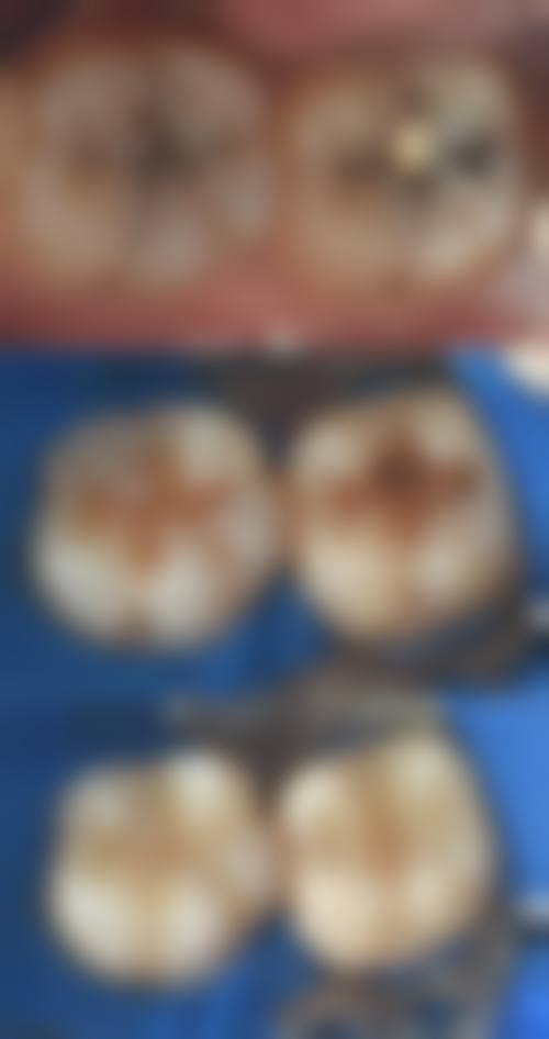 泰州益友口腔价格表(仅供参考)