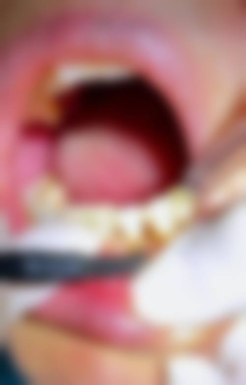 湖南张家界小牙匠口腔（夏小叶诊所）价格表（仅供参考）