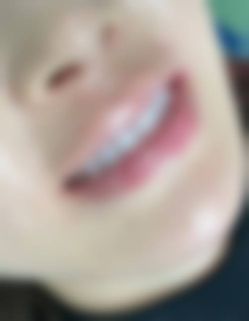 金华浦江伶牙口腔实例参考