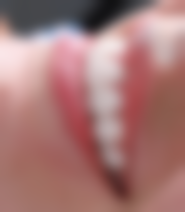 陕西安康乐牙士口腔实例参考