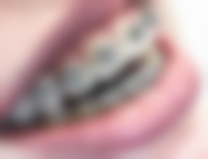 陕西渭南富平信远口腔核心项目