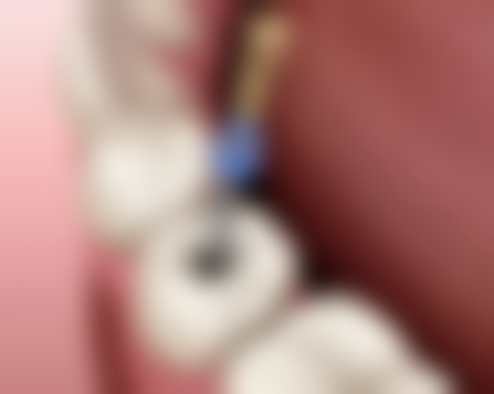 广东清远天易口腔怎么预约？