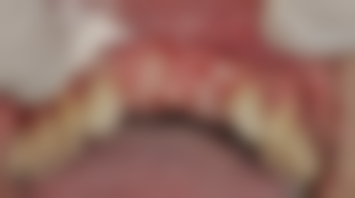 四川成都釉芽口腔实例参考