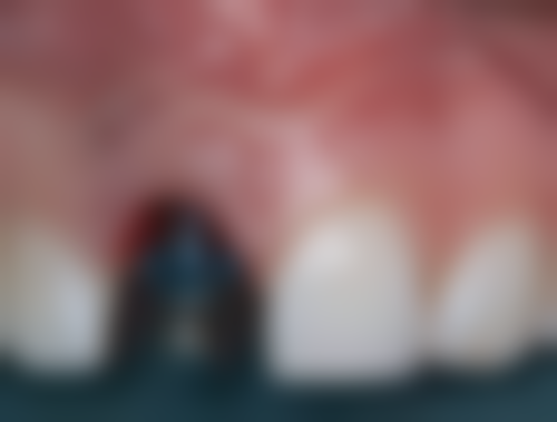 江西 南昌朝东口腔怎么预约？