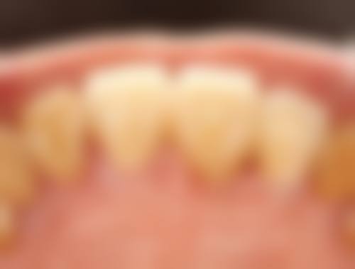 长沙优伢仕口腔(汽车西站店)核心项目