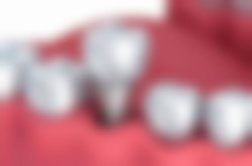 九江瑞昌齿杰口腔实例参考