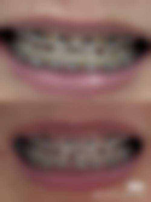 拉萨爱牙口腔（八廓商城店）核心项目