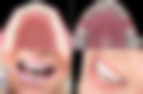 深圳乐芽口腔诊所（星航分店）实例参考