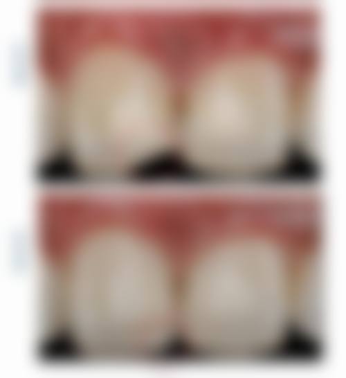 江门微笑牙科(乐盈里店)价格表(仅供参考)