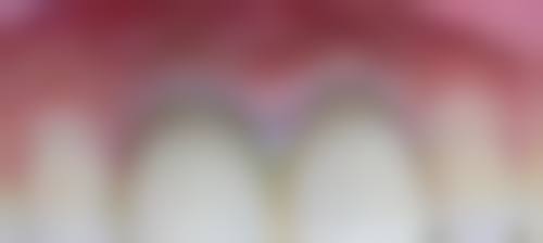 重庆雅致口腔(福庭路)怎么预约?