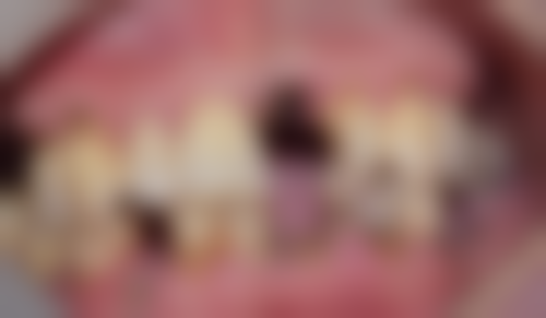 江苏镇江丹阳雅尔美口腔核心项目