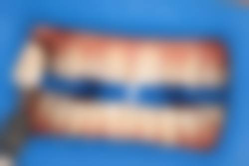 广州市花都微笑牙科门诊部价格表(仅供参考)