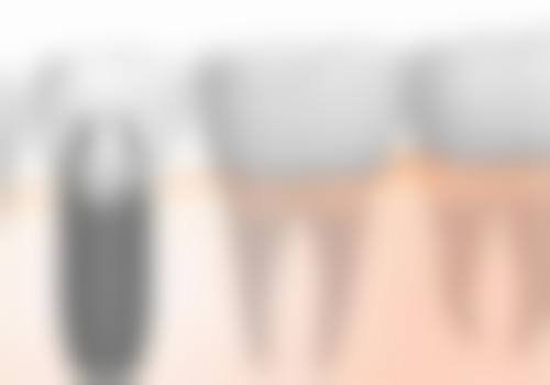 南宁超然口腔门诊部价格表（仅供参考）