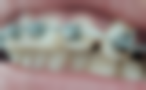 武汉大学口腔医院口腔颌面—头颈肿 瘤外科怎么预约？