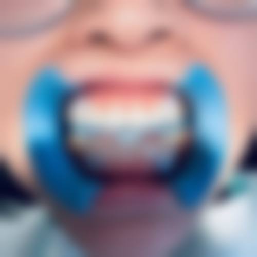 湖南长沙湘汇口腔怎么预约？