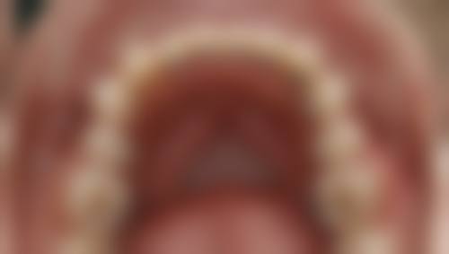 净月康呈口腔门诊部实例参考