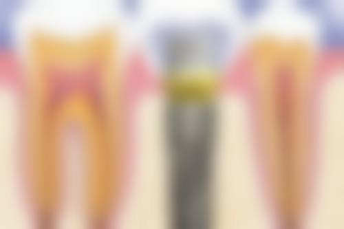 荣成美臻口腔诊所价格表(仅供参考)