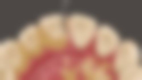 梅奥水恋口腔实例参考