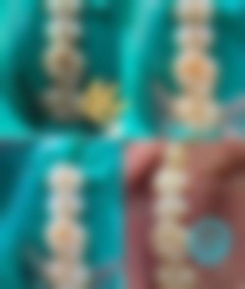 净月康呈口腔门诊部核心项目