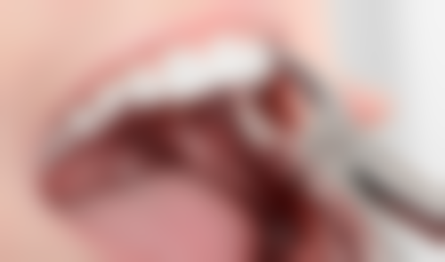 濮阳柏林牙医(振兴路门诊)实例参考