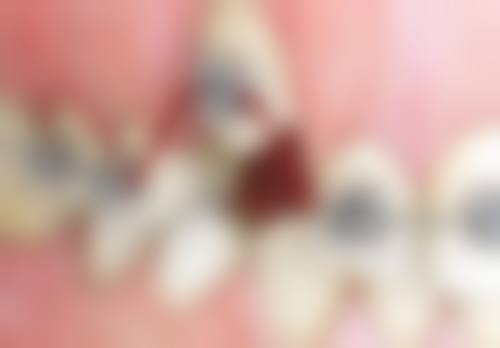 程玉虎擅长项目列表