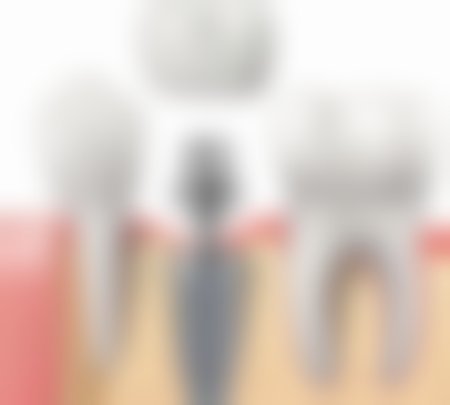 河南驻马店啄木鸟口腔连锁核心项目