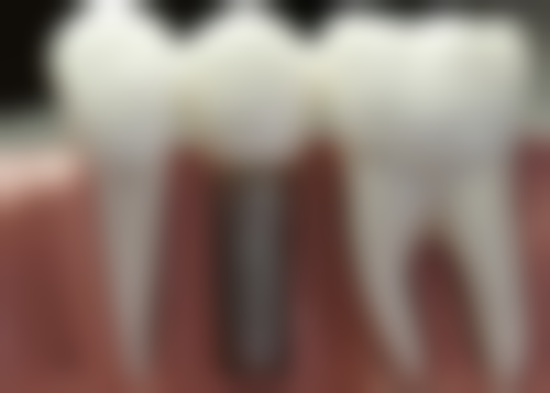 海南海口固皓口腔医院怎么预约？