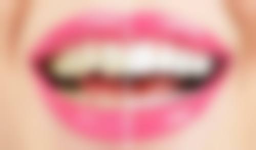 潜江美维中山口腔门诊部(水牛城店)实例参考