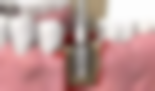 广州九二零齿科门诊部怎么预约?