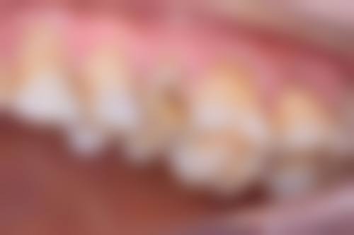 阜阳颍州郭丽口腔门诊部价格表(仅供参考)